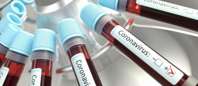  10 HASTANIN CORONAVİRÜS TESTİ POZİTİF ÇIKTI