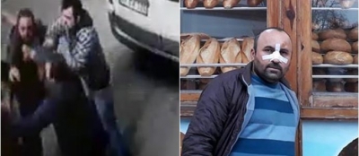 ESNAF BİRBİRİNE GİRDİ