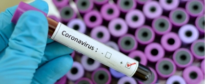 GÖKÇEBEY’DE CORONAVİRÜS VAKASI 