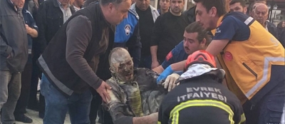 MEYDANDA KENDİNİ YAKTI!
