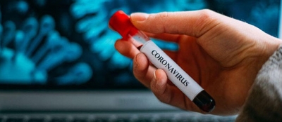 ZONGULDAK’TA CORONAVİRÜS’TEN ÖLENLERİN SAYISI 41’E YÜKSELDİ